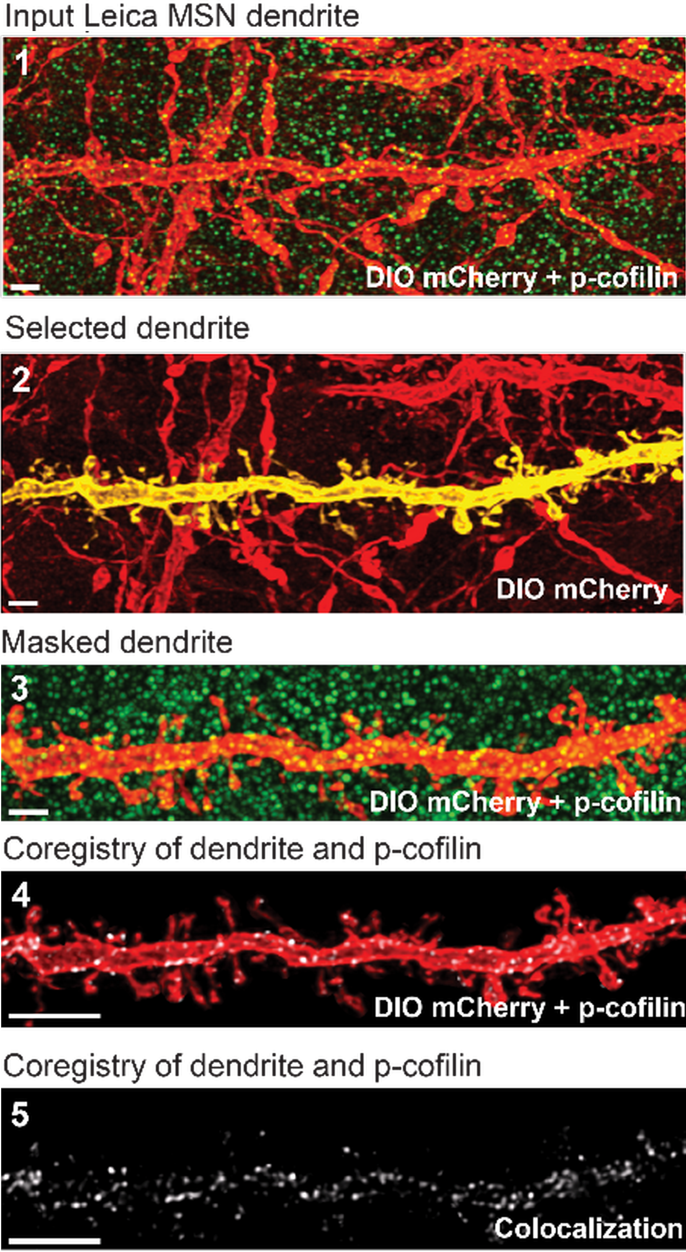 Garcia-Keller et al., Journal of Neuroscience 2020.