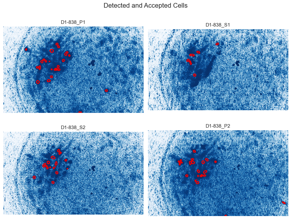 Calcium Imaging Data Pipeline